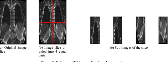 Figure 3 for Fast 3D Volumetric Image Reconstruction from 2D MRI Slices by Parallel Processing