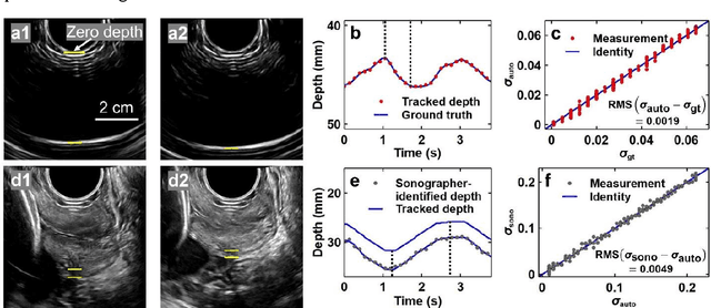 Figure 2 for Quantification of cervical elasticity during pregnancy based on transvaginal ultrasound imaging and stress measurement