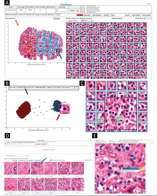 Figure 1 for PatchSorter: A High Throughput Deep Learning Digital Pathology Tool for Object Labeling
