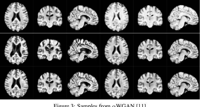 Figure 4 for Multiscale Metamorphic VAE for 3D Brain MRI Synthesis