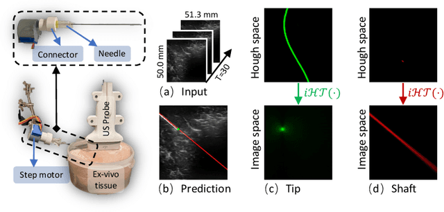Figure 3 for Invisible Needle Detection in Ultrasound: Leveraging Mechanism-Induced Vibration