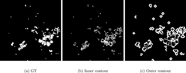 Figure 3 for A Global and Patch-wise Contrastive Loss for Accurate Automated Exudate Detection