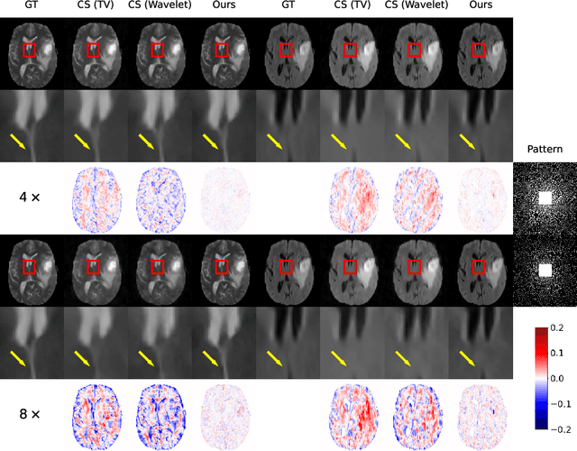 Figure 3 for Unsupervised Adaptive Implicit Neural Representation Learning for Scan-Specific MRI Reconstruction