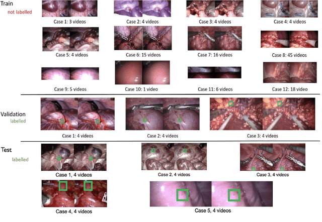 Figure 2 for SurgT challenge: Benchmark of Soft-Tissue Trackers for Robotic Surgery