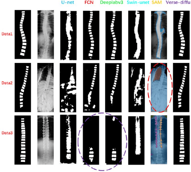 Figure 3 for Introducing Shape Prior Module in Diffusion Model for Medical Image Segmentation