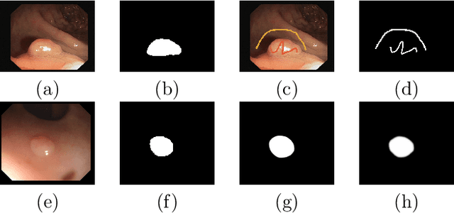 Figure 1 for Towards Automated Polyp Segmentation Using Weakly- and Semi-Supervised Learning and Deformable Transformers