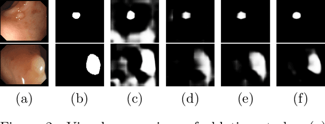 Figure 3 for Towards Automated Polyp Segmentation Using Weakly- and Semi-Supervised Learning and Deformable Transformers