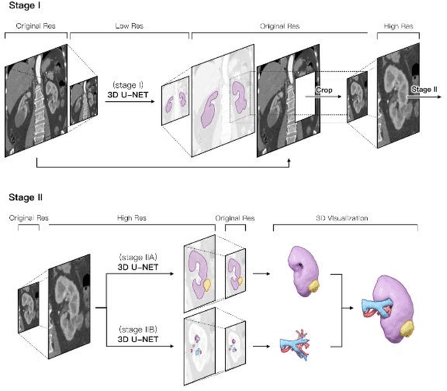 Figure 1 for An Entire Renal Anatomy Extraction Network for Advanced CAD During Partial Nephrectomy