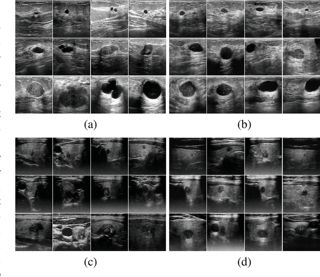 Figure 3 for Multi-Level Global Context Cross Consistency Model for Semi-Supervised Ultrasound Image Segmentation with Diffusion Model