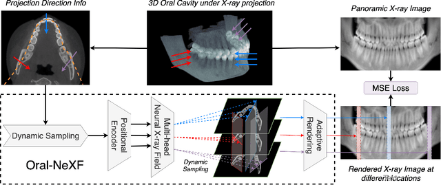 Figure 3 for Oral-NeXF: 3D Oral Reconstruction with Neural X-ray Field from Panoramic Imaging
