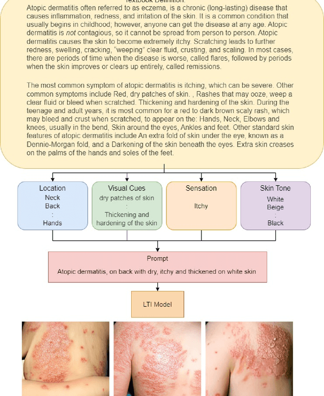 Figure 1 for Using Large Text-to-Image Models with Structured Prompts for Skin Disease Identification: A Case Study