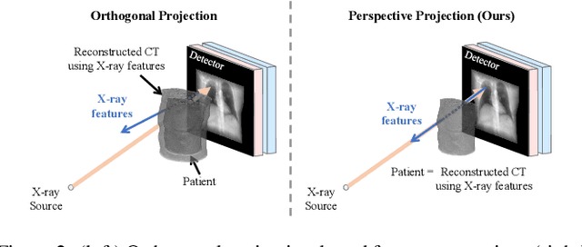 Figure 3 for Perspective Projection-Based 3D CT Reconstruction from Biplanar X-rays