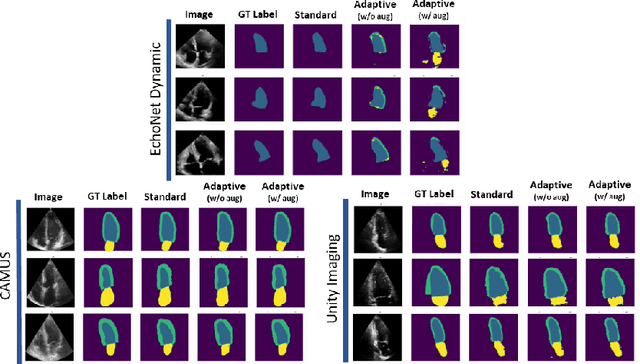 Figure 3 for Label Dropout: Improved Deep Learning Echocardiography Segmentation Using Multiple Datasets With Domain Shift and Partial Labelling