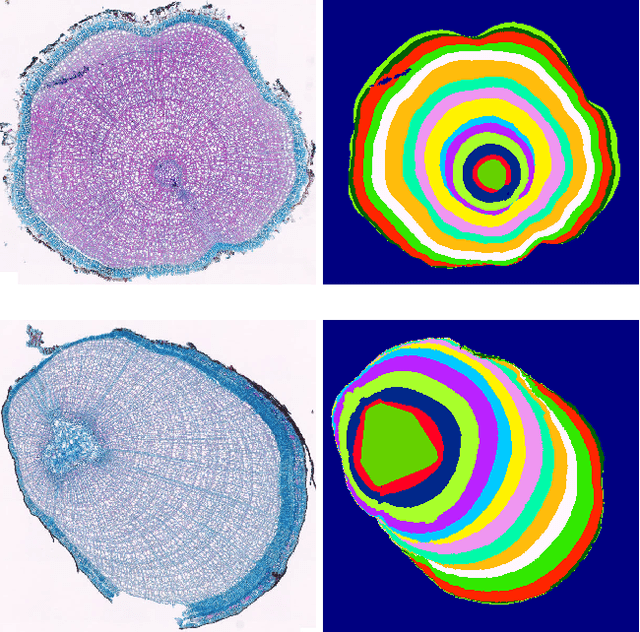 Figure 1 for Iterative Next Boundary Detection for Instance Segmentation of Tree Rings in Microscopy Images of Shrub Cross Sections