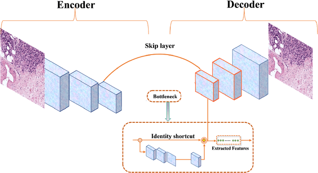 Figure 1 for Self-supervised learning of a tailored Convolutional Auto Encoder for histopathological prostate grading