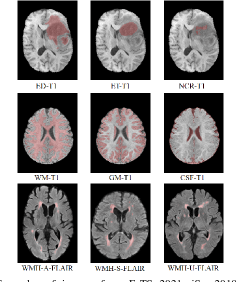 Figure 2 for Finding the Most Transferable Tasks for Brain Image Segmentation