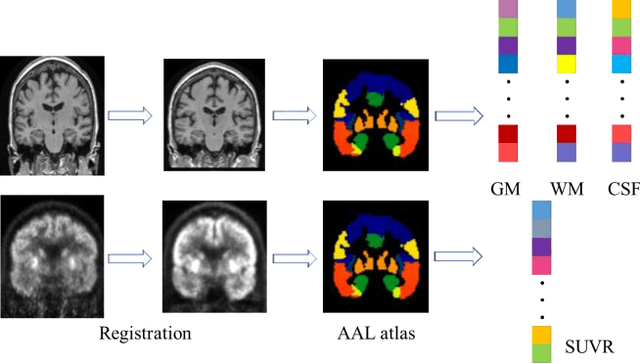Figure 1 for Multi-modal Graph Neural Network for Early Diagnosis of Alzheimer's Disease from sMRI and PET Scans