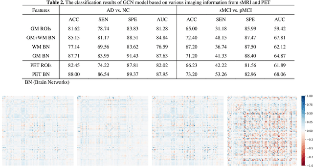 Figure 4 for Multi-modal Graph Neural Network for Early Diagnosis of Alzheimer's Disease from sMRI and PET Scans