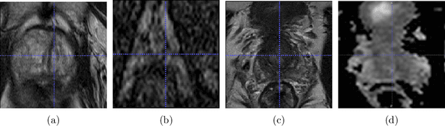 Figure 1 for Domain Transfer Through Image-to-Image Translation for Uncertainty-Aware Prostate Cancer Classification