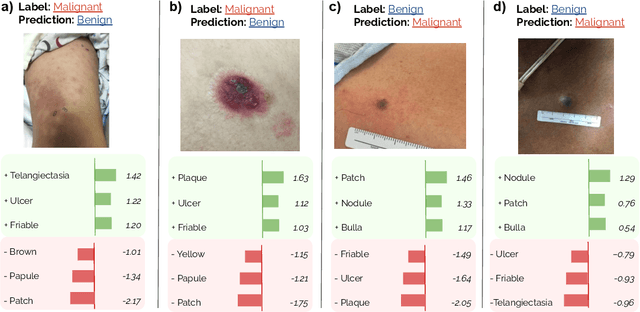 Figure 4 for SkinCon: A skin disease dataset densely annotated by domain experts for fine-grained model debugging and analysis