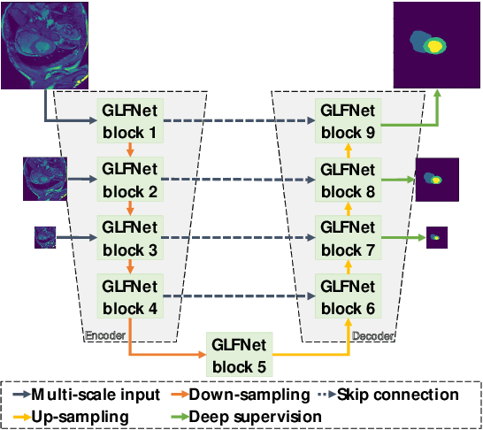 Figure 1 for GLFNET: Global-Local (frequency) Filter Networks for efficient medical image segmentation