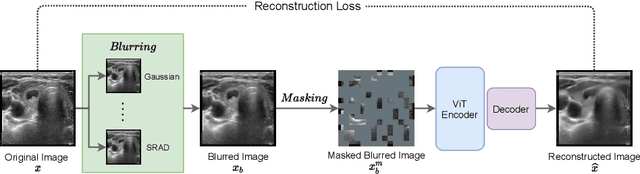 Figure 1 for Deblurring Masked Autoencoder is Better Recipe for Ultrasound Image Recognition