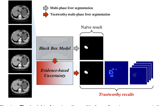 Figure 1 for Trustworthy Multi-phase Liver Tumor Segmentation via Evidence-based Uncertainty