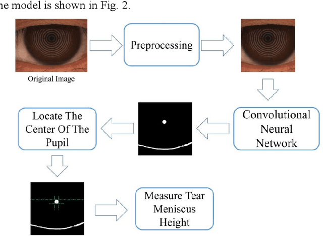 Figure 3 for An edge detection-based deep learning approach for tear meniscus height measurement