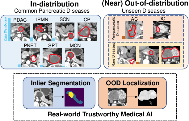 Figure 1 for Devil is in the Queries: Advancing Mask Transformers for Real-world Medical Image Segmentation and Out-of-Distribution Localization