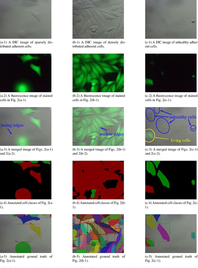 Figure 3 for Dual-View Selective Instance Segmentation Network for Unstained Live Adherent Cells in Differential Interference Contrast Images