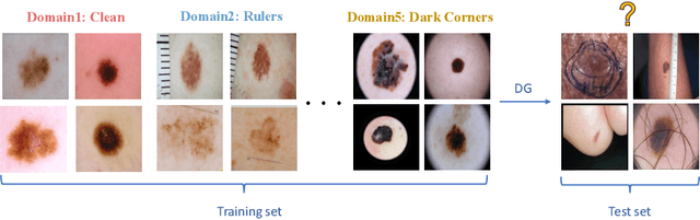 Figure 1 for EPVT: Environment-aware Prompt Vision Transformer for Domain Generalization in Skin Lesion Recognition
