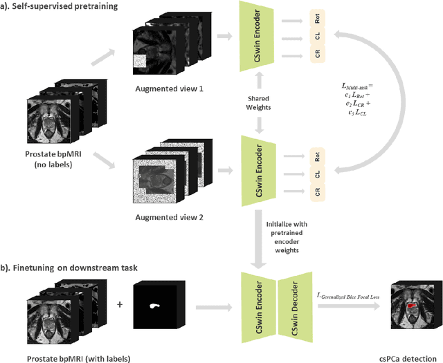 Figure 1 for Cross-Shaped Windows Transformer with Self-supervised Pretraining for Clinically Significant Prostate Cancer Detection in Bi-parametric MRI