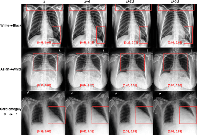 Figure 2 for Visualizing chest X-ray dataset biases using GANs