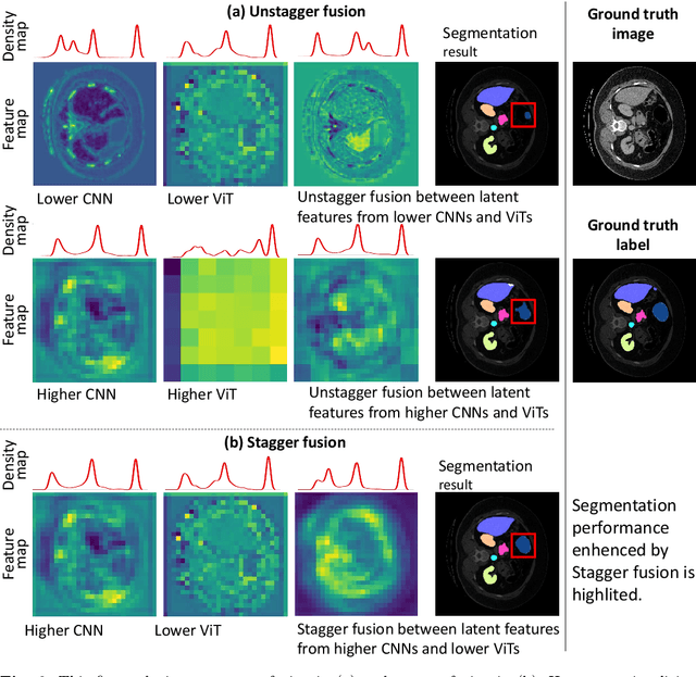 Figure 2 for Rethinking Information Loss in Medical Image Segmentation with Various-sized Targets