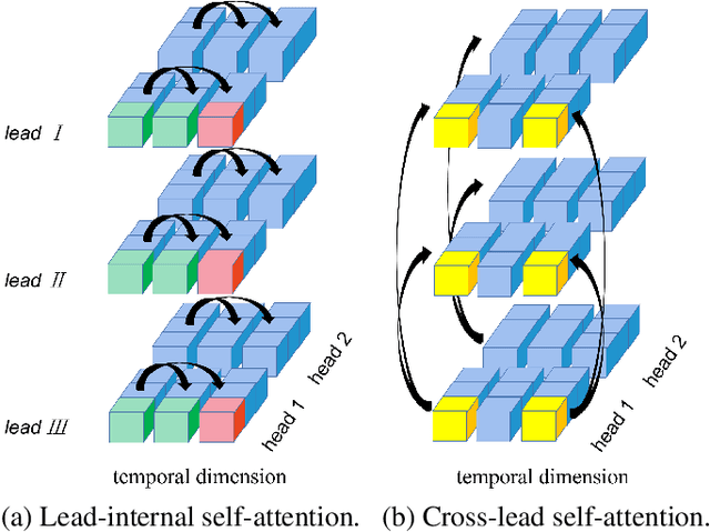 Figure 3 for A Dual-scale Lead-seperated Transformer With Lead-orthogonal Attention And Meta-information For Ecg Classification