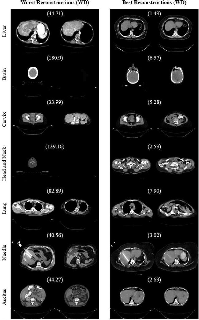 Figure 2 for StyleGAN2-based Out-of-Distribution Detection for Medical Imaging