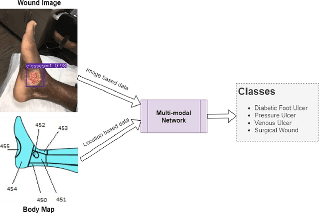 Figure 1 for Integrated Image and Location Analysis for Wound Classification: A Deep Learning Approach