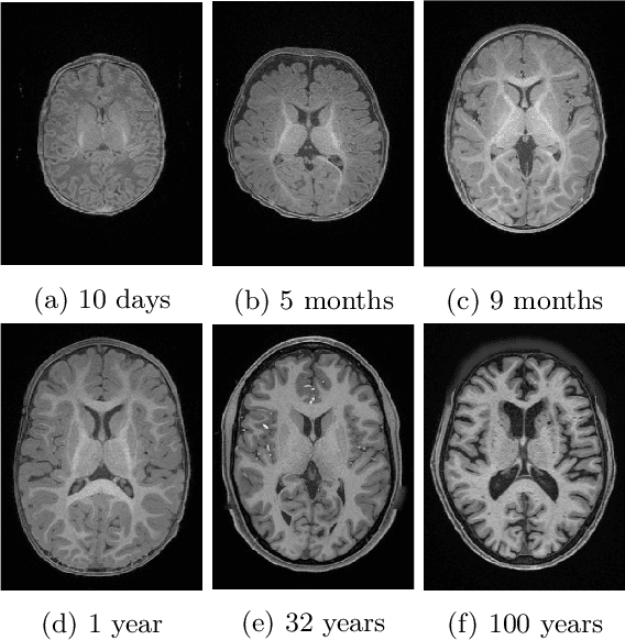 Figure 1 for Brain Tissue Segmentation Across the Human Lifespan via Supervised Contrastive Learning