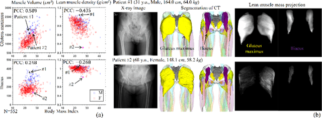 Figure 1 for MSKdeX: Musculoskeletal (MSK) decomposition from an X-ray image for fine-grained estimation of lean muscle mass and muscle volume