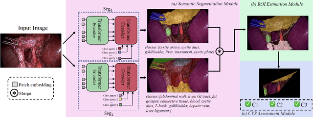 Figure 2 for Automated Assessment of Critical View of Safety in Laparoscopic Cholecystectomy