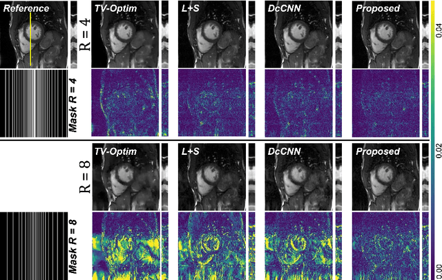 Figure 4 for Global k-Space Interpolation for Dynamic MRI Reconstruction using Masked Image Modeling