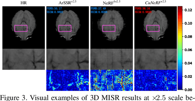 Figure 4 for CuNeRF: Cube-Based Neural Radiance Field for Zero-Shot Medical Image Arbitrary-Scale Super Resolution