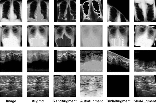Figure 3 for MedAugment: Universal Automatic Data Augmentation Plug-in for Medical Image Analysis