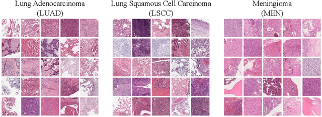 Figure 1 for Re-identification from histopathology images