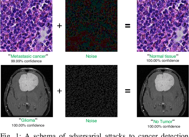 Figure 1 for Exploring adversarial attacks in federated learning for medical imaging