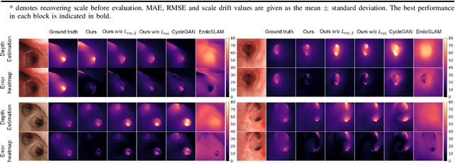 Figure 4 for DD-VNB: A Depth-based Dual-Loop Framework for Real-time Visually Navigated Bronchoscopy