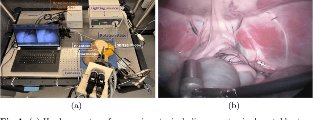 Figure 1 for Detecting the Sensing Area of A Laparoscopic Probe in Minimally Invasive Cancer Surgery
