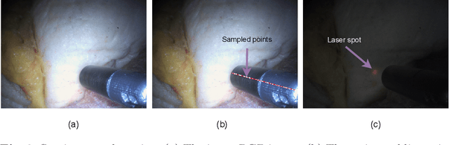 Figure 4 for Detecting the Sensing Area of A Laparoscopic Probe in Minimally Invasive Cancer Surgery