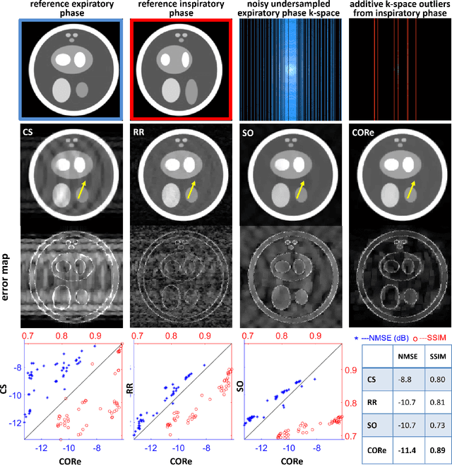 Figure 4 for Motion-robust free-running cardiovascular MRI