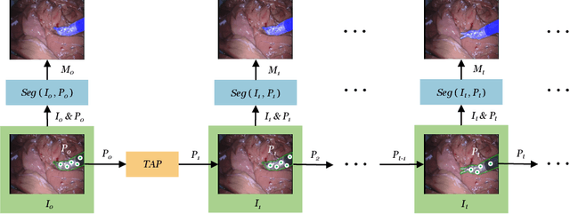 Figure 3 for Real-time Surgical Instrument Segmentation in Video Using Point Tracking and Segment Anything